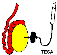 testicular extract